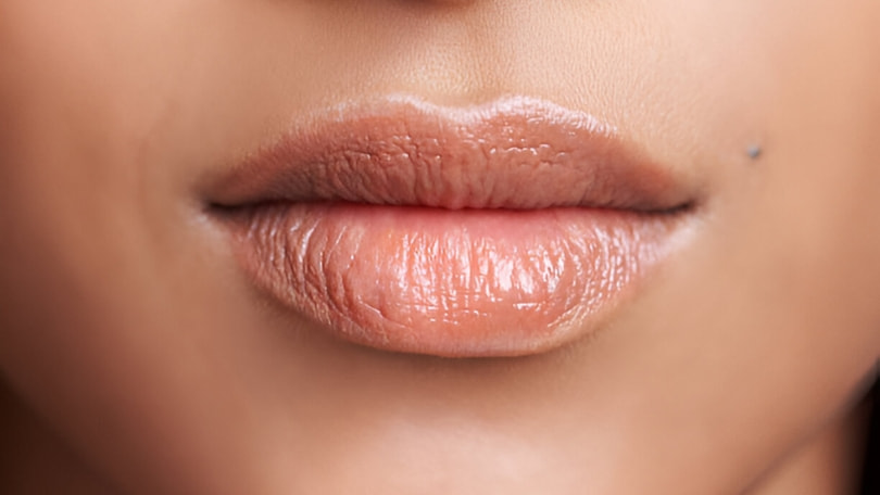 Tratamiento para aumento de labios - Dr Javier Arnaiz