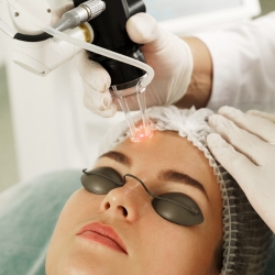 Láser picosegundo QS - Medicina estética en Santander
