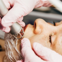 Resurfacing fraccionado ablativo - Medicina Estética Santander