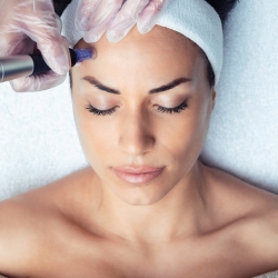 Microneedling con SKINPEN en Santander - Medicina Estética Santander