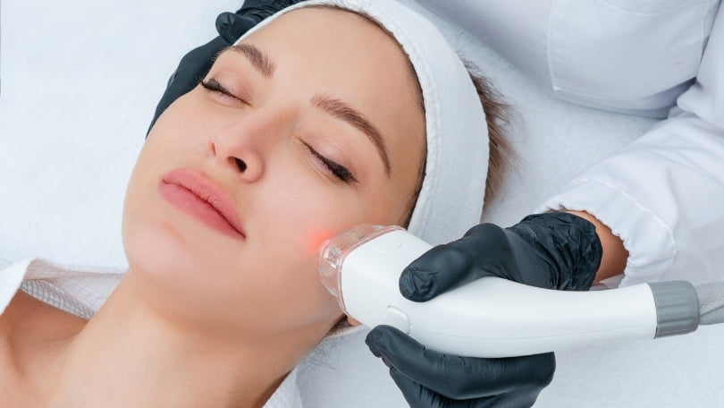 Cuidados de la piel tras realizar tratamiento facial con láser