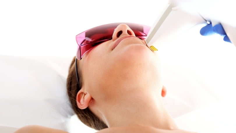 Láser fraccionado para manchas y cicatrices