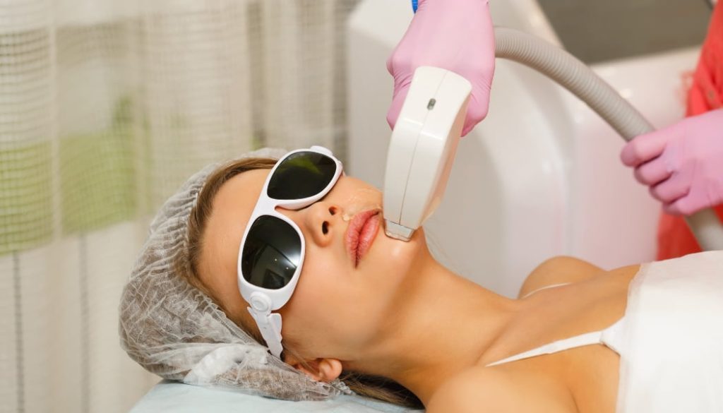 Qué es el Láser 360º facial